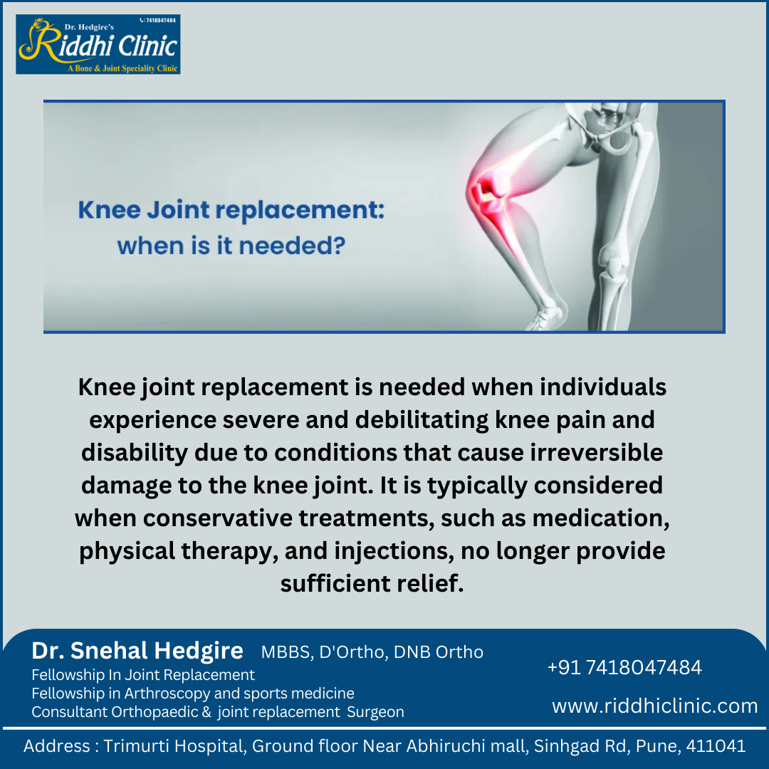 knee Replacement in Dhayari