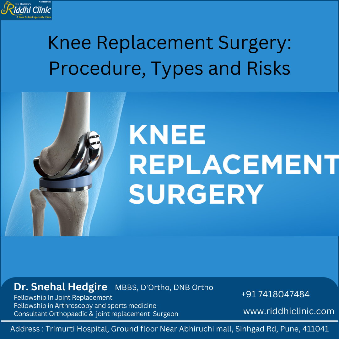 knee replacement in dhayri