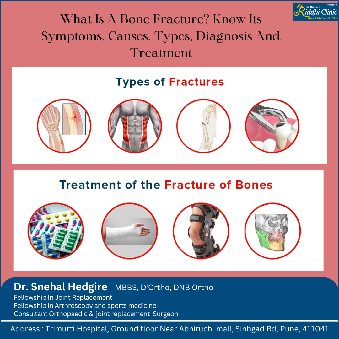 What Is a Bone Fracture? Symptoms, Causes, Types, Diagnosis, and Treatment