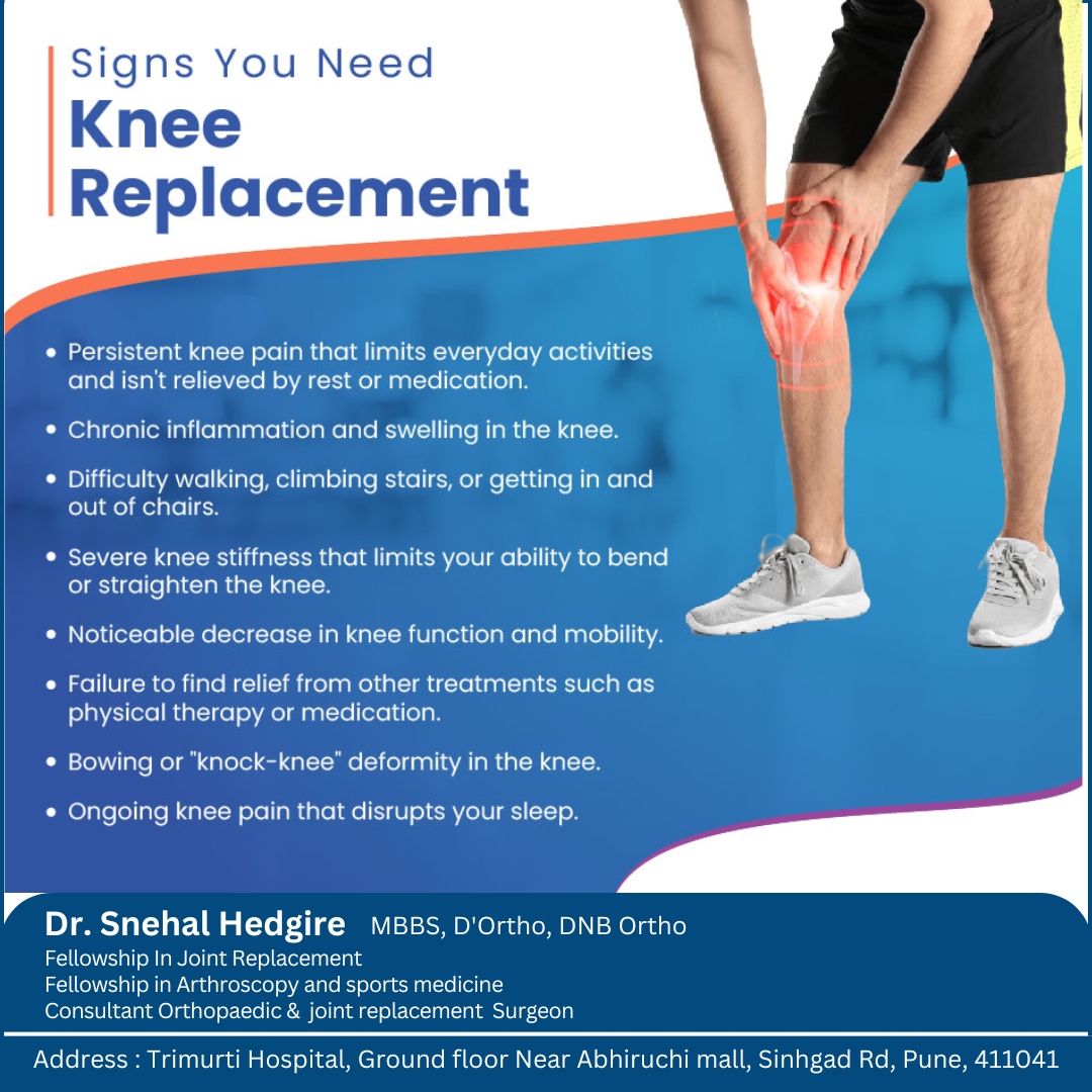 Signs You Might Need a Knee Replacement