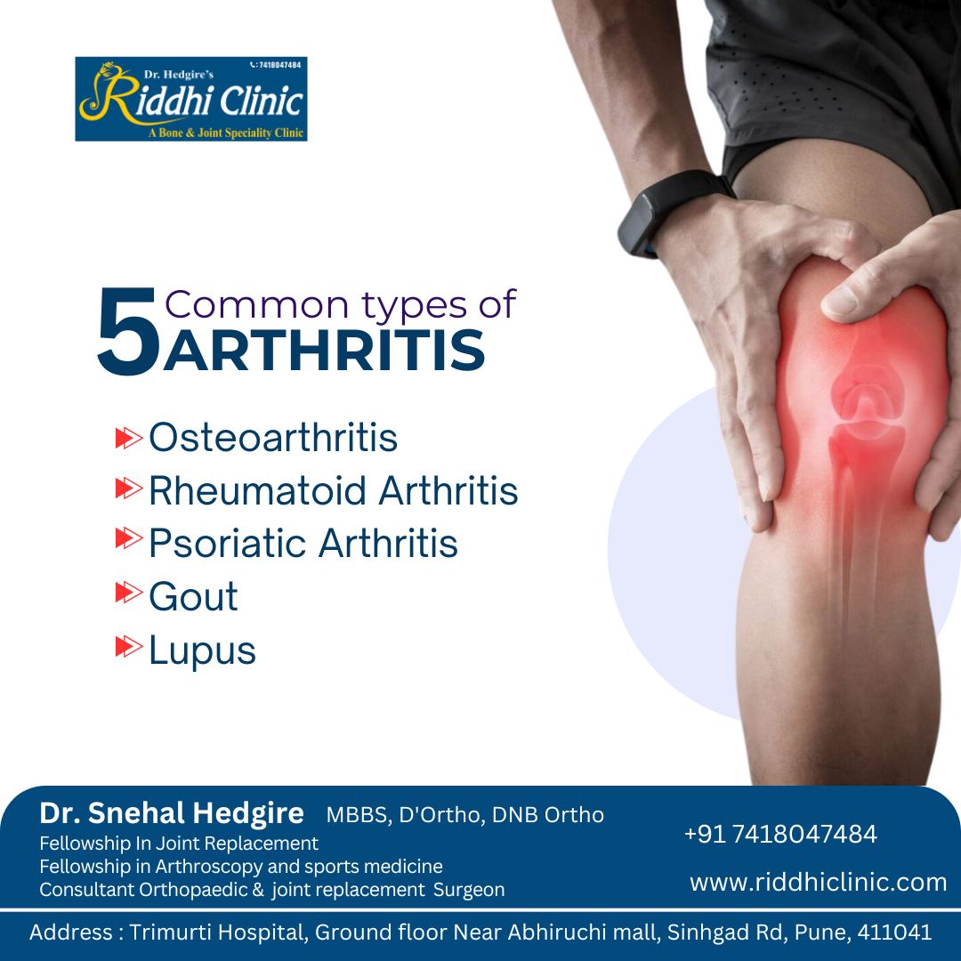 Types of Arthritis