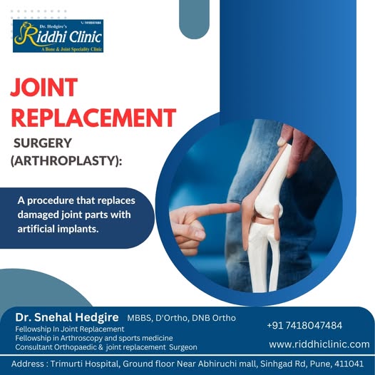 Joint Replacement Surgery in pune